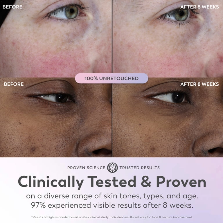 5-in-1 Multi-Benefit Brightening Facial Serum photo 8