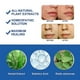 thumbnail image 5 of ZHAOCHENG Crema para eliminar verrugas y lunares, 50 g, 5 of 5