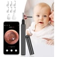thumbnail image 1 of Ear Wax Removal,Ear Cleaner with 1080P FHD Camera,Wireles Otoscope,Ear Wax Removal Kit,Ear Endoscope with 6 LED Lights,Ear Wax Removal Tool,Ear Camera iOS,Android Smartphones&Tablets (Black), 1 of 7