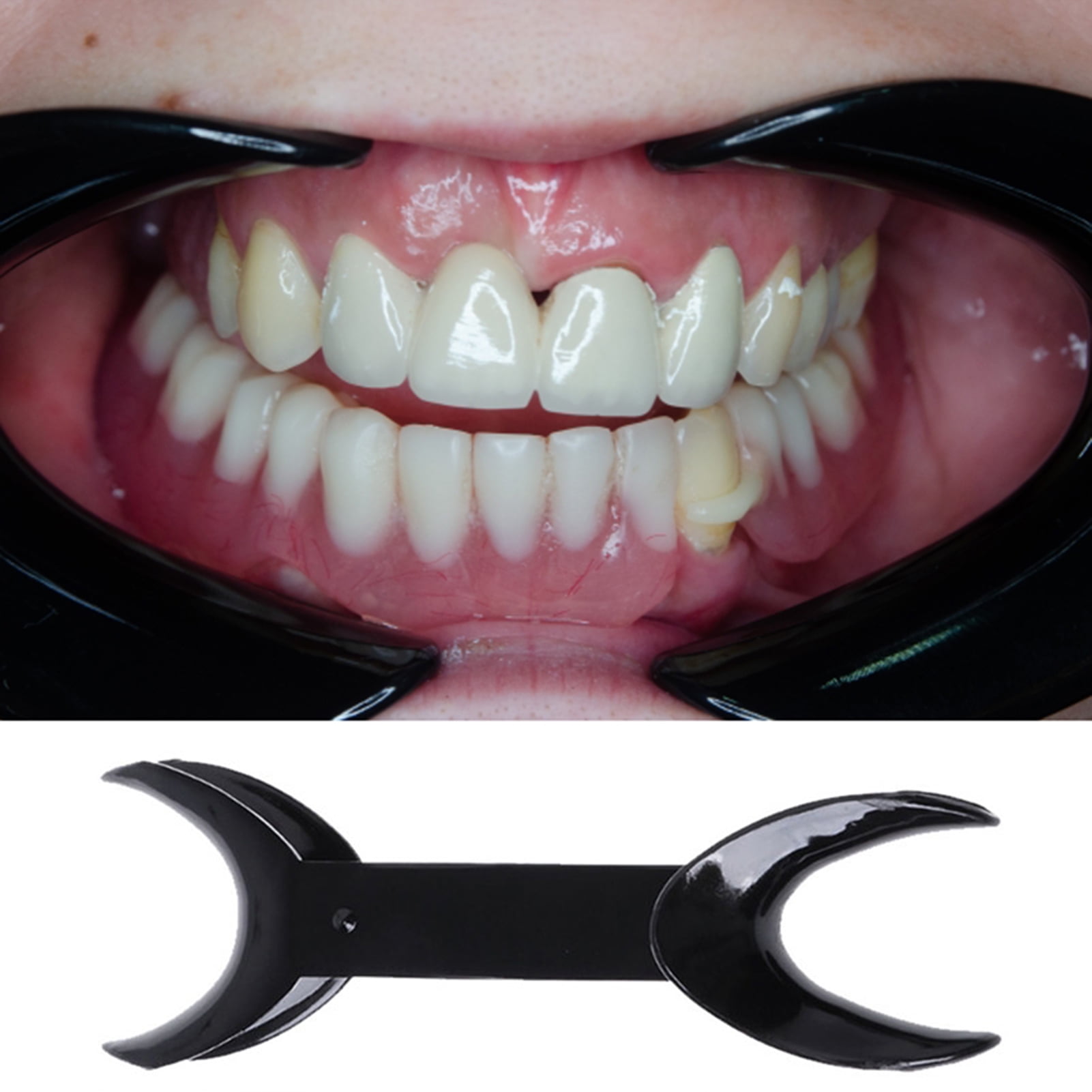 YILON Cut out cheek op YILON Cut out cheek op 6 Minnesota Cheek