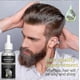 thumbnail image 3 of Pure Organic Essential Oil for Hair and Skin, Rosemary Formula to Support Scalp Health and Nourishment, 3 of 5