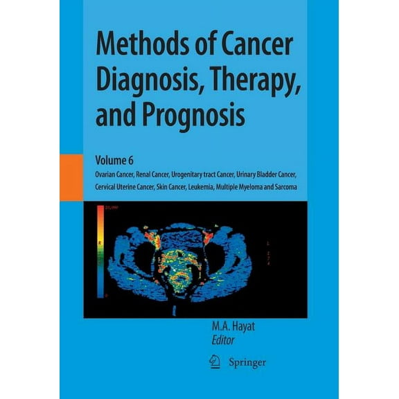 Methods of Cancer Diagnosis, Therapy and Methods of Cancer Diagnosis, Therapy, and Prognosis: Ovarian Cancer, Renal Cancer, Urogenitary Tract Cancer, Urinary Bla, Book 6, (Paperback)