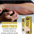 thumbnail image 4 of Psoriasis Treatments Cream, Psoriasis Cream, Anti-itch Cream, Soothing Cream for Psoriasis, Relieves Itching and Soothes Irritated Skin, 4 of 5