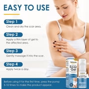Scar Cream, Scar Mark Removal for C-Section, Stretch Marks, Acne, Surgery, Effective for Both Old and New Scars