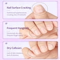 thumbnail image 4 of Juego de rotuladores para cuidado de uñas KAHSOSE, 3 en 1, con aceite para cutículas, 3 unidades, 4 of 7