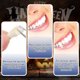 thumbnail image 2 of Jumpingount 5 piezas de dientes de vampiro fáciles de usar de resina: dentaduras postizas personalizables y confiables, colmillos personalizados, cuidado de los oídos, 2 of 6