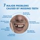 thumbnail image 5 of Dentadura parcial removible personalizada Qiivosm, set de 6 dientes, 5 of 7