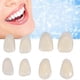 thumbnail image 3 of 70pcs/bag Teeth Veneers Resin Anterior Upper Temporary Crown For Oral Care - ya, 3 of 4