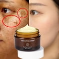 thumbnail image 1 of Crema facial de cúrcuma para cara y cuerpo, loción iluminadora de piel de cúrcuma Natural, crema con vitamina E con ácido hialurónico y colágeno"50g" Fivean LED, 1 of 2
