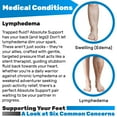 thumbnail image 3 of Compression Stockings for Women and Men 20-30mmHg with Open Toe - Beige, Large, 3 of 10