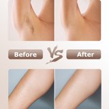 thumbnail image 2 of IPL Laser Hair Removal, 999,900 Flashes Painless 9 Levels Permanent Hair Removal Machine, 2 of 8