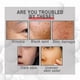 thumbnail image 5 of Collagen Boost Anti-aging, Anti-aging Serum, Collagen Boost Anti-aging Serum Anti Wrinkle Serum, Blemish Skin Co, 5 of 5