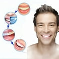 thumbnail image 3 of XIRQI 2026 New 4Pcs Night Mouth Guard for Teeth Grinding Bruxism Protector Bites Brace, for Protecting Teeth, Reducing Jaw Tension, Preventing Enamel Wear, Improving Sleep Quality, 3 of 5