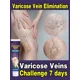 thumbnail image 5 of Vasos sanguíneos de araña, venas varicosas, alivio efectivo de las venas varicosas para aliviar la vasculitis, la flebitis, el tratamiento del dolor de araña, 5 of 5