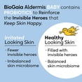 thumbnail image 4 of Pomada probiótica BioGaia Aldermis para bebés y niños pequeños 24 ml, 4 of 6