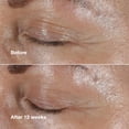 thumbnail image 4 of Crema para ojos Clinique Smart Clinical Repair Wrinkle 30 ml, 4 of 7