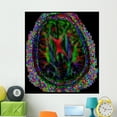 thumbnail image 1 of Brain Mri Wall Mural by Wallmonkeys Peel and Stick Graphic (48 in H x 48 in W) WM197016, 1 of 4