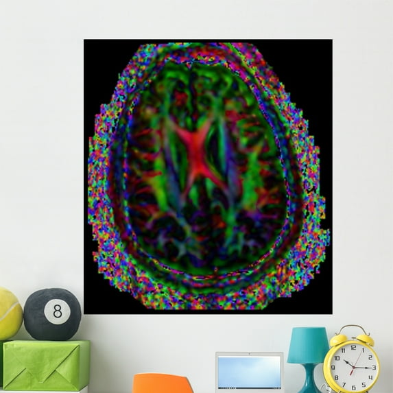 Brain Mri Wall Mural by Wallmonkeys Peel and Stick Graphic (48 in H x 48 in W) WM197016