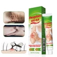 thumbnail image 3 of Mosquito and bug bite itch relief Mosquito Anti itch Cream Natural Herbal Mosquito Repellent Cream Mosquito and Bug Bite Itch Relief ANGGREK Otros, 3 of 8