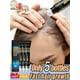 thumbnail image 2 of Prevención de la caída del cabello Premium, suero anticaída eficaz, tratamiento del cuero cabelludo, cuidado hereditario posparto seborreico del cabello, 2 of 5