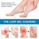 thumbnail image 4 of 1-6pcs SOUTH MOON SOA08-A059-2-BU1 1 Pair Metatarsal Pads Forefoot Pressure Reducer Toe Loop Gel Cus, 4 of 5