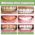 thumbnail image 2 of 10/20/30pcs Eelhoe Ampoule Toothpaste, Ampoule Tooth Serum, Ampoule Essence Toothpaste -8499998105651, 2 of 5