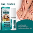 thumbnail image 2 of 1-3pcs Nail Fungal Brush Against Nail Fungal Infection 2 In1 Treat & Brighten Nails 5ml, 2 of 5