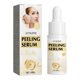 thumbnail image 2 of Hot6sl Ofertas Del Día Cicatrices Eliminables Faciales Naturales 30 Ml, 2 of 7