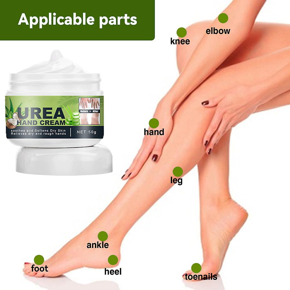 Cream for ankle cracks new arrivals