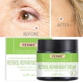 thumbnail image 1 of Xihbxyly Ofertas diarias Crema hidratante en retinol, reafirmante, hidratante, desalinizadora, líneas finas, iluminadora, antienvergecimiento, crema viva, 50 g, 1 of 7