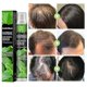 thumbnail image 2 of Spray para el crecimiento del cabello Líquido para el crecimiento Nutrición sólida para el cabello Hidratación del cabello - 3668951825515, 2 of 5