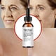 thumbnail image 2 of Solución de ácido salicílico al 2 % para eliminar manchas de acné, reducir los poros, controlar la grasa y aclarar la piel del rostro. Suero de vitamina C para el rostro, 2 of 6