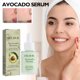 thumbnail image 5 of Teissuly Moisturizing Skin Moisturizing Brightening Facial Complexion Lightening Serum 30ml Teissuly WER202401272292, 5 of 9