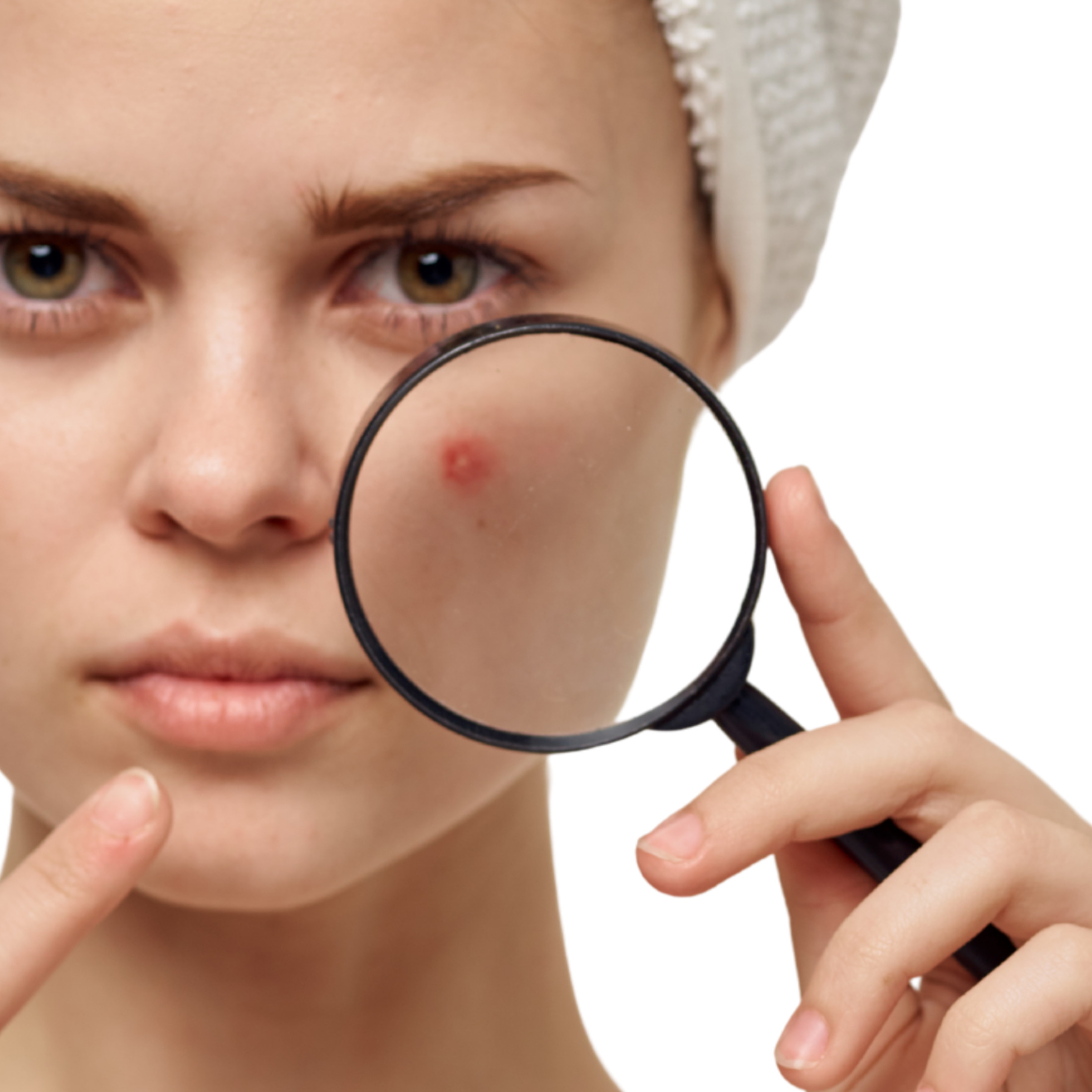 Mettalusso MORIIS Modern Acne and Post Shave Skincare Treatment