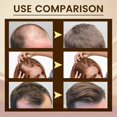 thumbnail image 4 of Thickening hair essence nourishes hair roots, strengthens hair, prevents hair loss, repairs damaged hair, thickens hair essence 30ml, 4 of 4