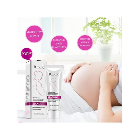 VICOODA Prevention And Repair Of Stretch Marks,Downplays Scars,Stretch Mark