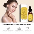 thumbnail image 3 of Improve Dark Yellow Moisturizing And Skin Frankincense Oil 30ml, 3 of 9