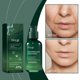 thumbnail image 2 of Hoygi Facial Essence, Brightening, Moisturizing, Light Line, Moisturizing, Anti-Wrinkle, Delicate Pores Skin Care Essence, 2 of 5