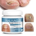 thumbnail image 3 of 20g Mild Nails Care Cream Onychomycosis Care Ointments for Finger Toe Nail, 3 of 5