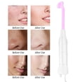 thumbnail image 1 of High Frequency Electrotherapy Purple Light Skin Tightening Beauty Machine Facial Care US Plug, 1 of 8
