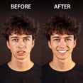 thumbnail image 2 of Tiras blanqueadoras dentales GNAW LABS, 14 tratamientos, aceite de coco, 2 of 9