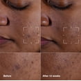 thumbnail image 2 of Serum Clinique Even Better Clinical para eliminar manchas oscuras, 75 ml, 2 of 9