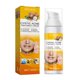 thumbnail image 4 of Crema de eliminación de acné quístico de 30 ml reparación hidratante antiacné blanqueamiento de la piel Sywqhk Cuidado Belleza, 4 of 6