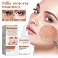thumbnail image 2 of Éliminateur de Milium - Dissout & Réduit Milium, Whitehead, Hyperplasia Sébacé - 30ml, 2 of 5