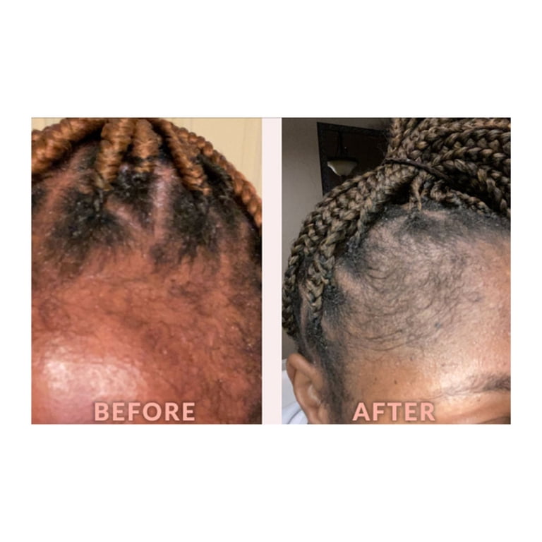Design Essentials Edge & Temple Strengthening Hair Oil, 4 fl oz photo 4