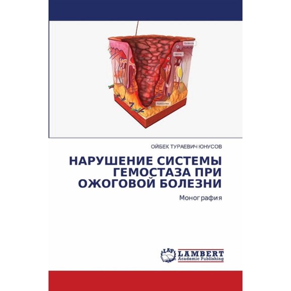 НАРУШЕНИЕ СИСТЕМЫ Г, (Paperback)