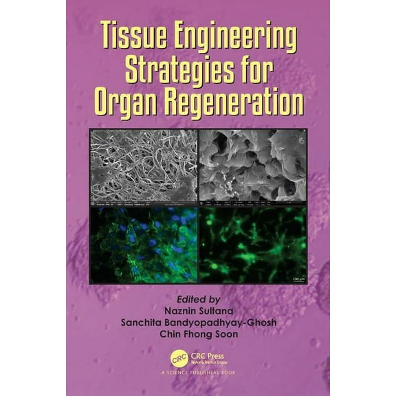 Tissue Engineering Strategies for Organ Regeneration, (Hardcover)