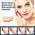 thumbnail image 3 of Skin Care gel Gentle Care Body Skin Bump Smooth Skin Moisturizing gel, 3 of 5