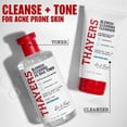 thumbnail image 4 of THAYERS Witch Hazel Blemish Toner, 12 OZ, 4 of 9