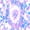 Blue Pink White, variant on Erosebridal Spiral Tie Dye Pattern Zipper Twin Comforter Sets with Fitted Sheet and 2 Pillowcases,Radial Swirl Print Zipper Bedding Set,Turquoise Orange Black,Black Reversible